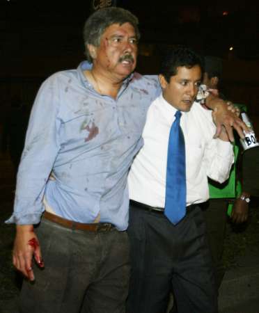 Раненному мужчине помогают после взрыва автомобильной бомбы в Боготе, 07 февраля 2003 г. Как сообщили полиция и свидетели, мощная автомобильная бомба, взорвлась в одном из самых элитных клубов столицы Колумбии, убив по крайней мере одного человека и многих ранив. Взрыв был устроен в клубе Ногаль, часто посещаемом израненной войной национальной элитой и иностранными дипломатами. Место жительства американского посла - позади Клуба Ногаль. Пожарные сказали, что множество людей оказались поймаными внутри здания как в ловушке. Аннотация и фото: Даниэль Муньос, агентство Рейтер; пятница, 07 февраля 2003 г., 10 ч. 53 мин. всемирного времени